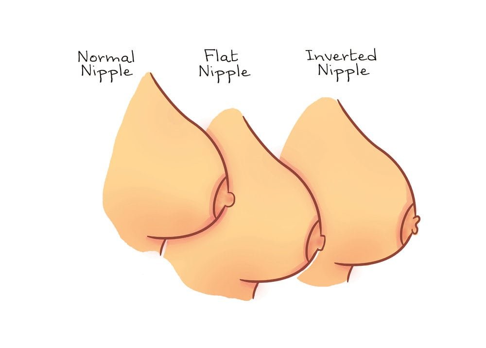 nipple types